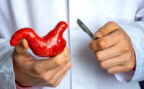 Chirurgia Gastrica in Turchia | Cayra Clinics Istanbul & Antalya