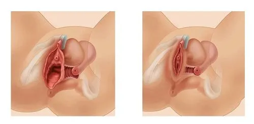 L’estetica vaginale: cos’è e quali sono i trattamenti