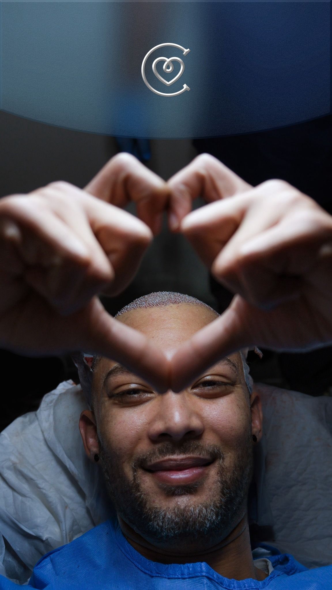 Tecnica DHI Trapianto Capelli | Istanbul e Antalya