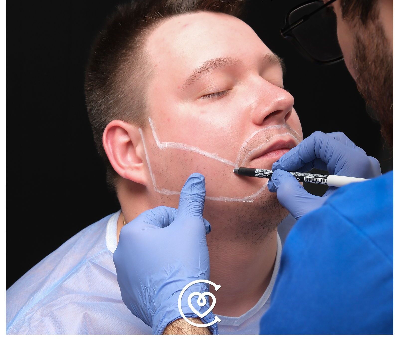 Trapianto Barba Naturale | Istanbul e Antalya