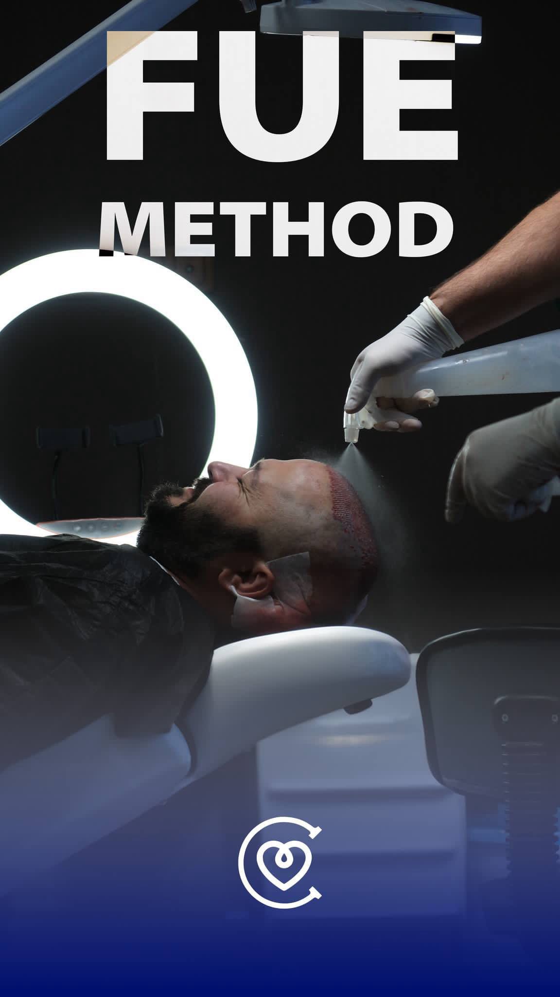 Trapianto Capelli Zaffiro FUE | Cayra Clinics Turchia