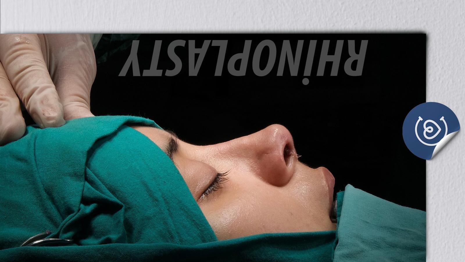 Rinoplastica Chirurgica | Cayra Clinics Istanbul e Antalya