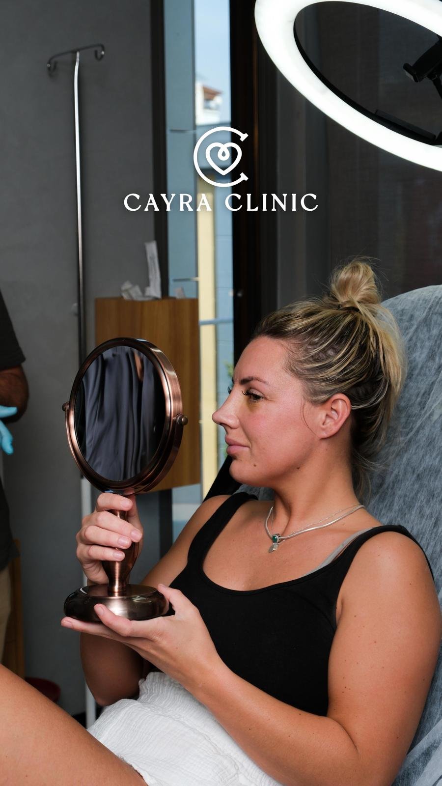 Rinoplastica Non Invasiva con Filler | Cayra Clinics Turchia