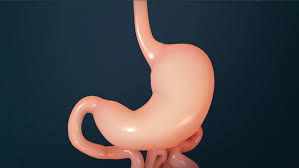 Paziente sottoposto a bypass gastrico presso Cayra Clinic per una significativa perdita di peso