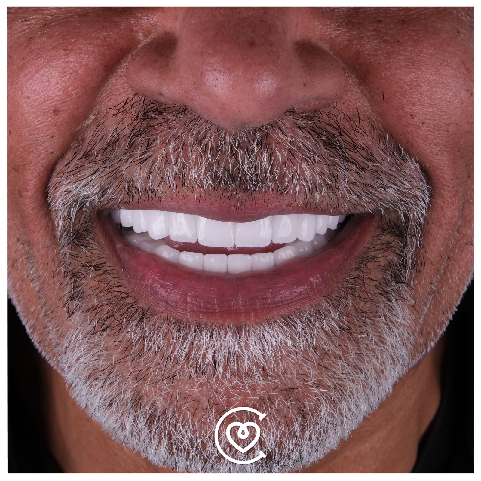 Trattamenti dentali in Turchia