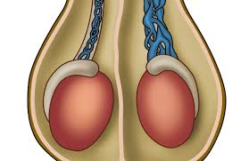 Tasso di successo della microchirurgia del varicocele a Cayra Clinic in Turchia con risultati ottimali