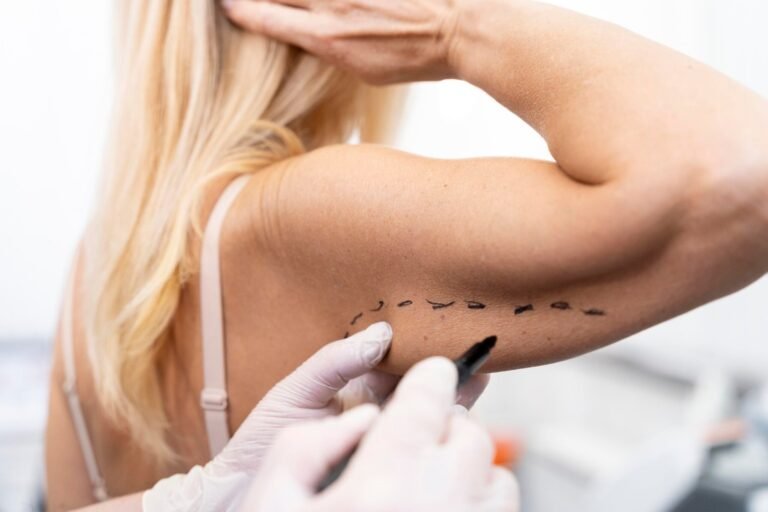 Risultati prima e dopo la liposuzione delle braccia presso Cayra Clinic per un rimodellamento naturale