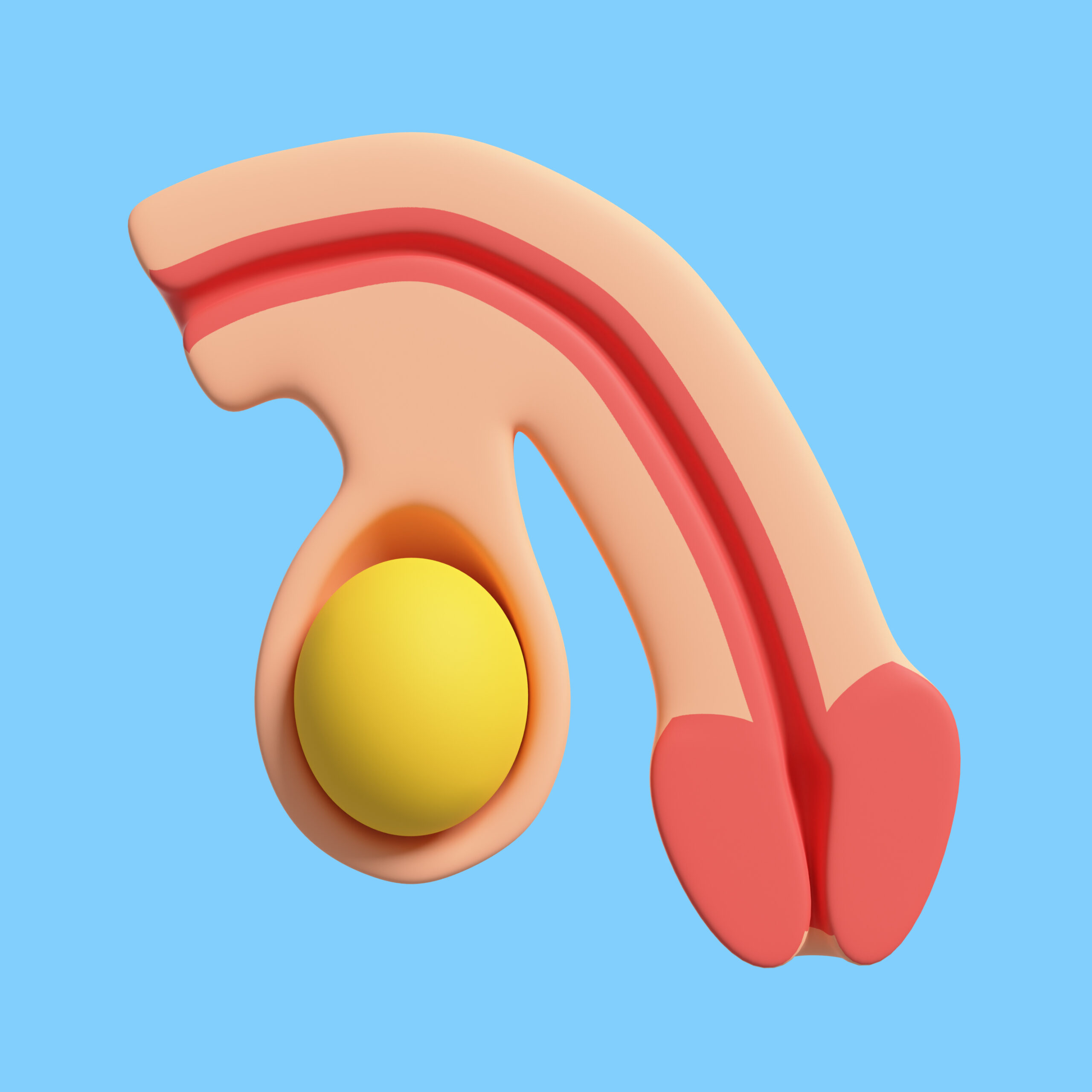 Impianto penieno per il trattamento della disfunzione erettile presso Cayra Clinic