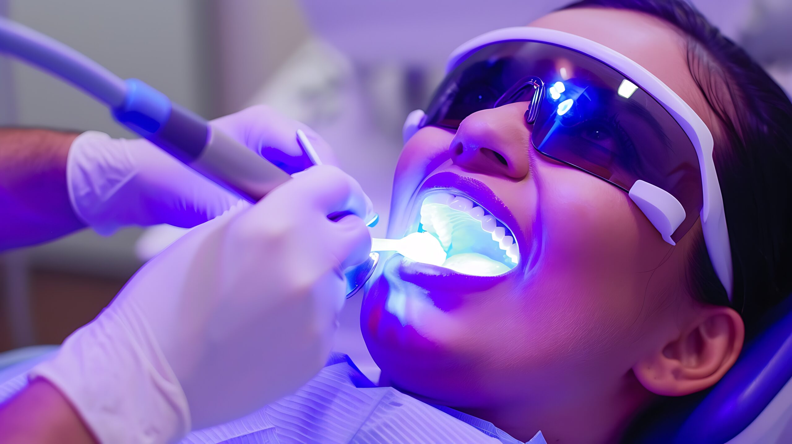 Sbiancamento dentale professionale presso Cayra Clinic per un sorriso più luminoso