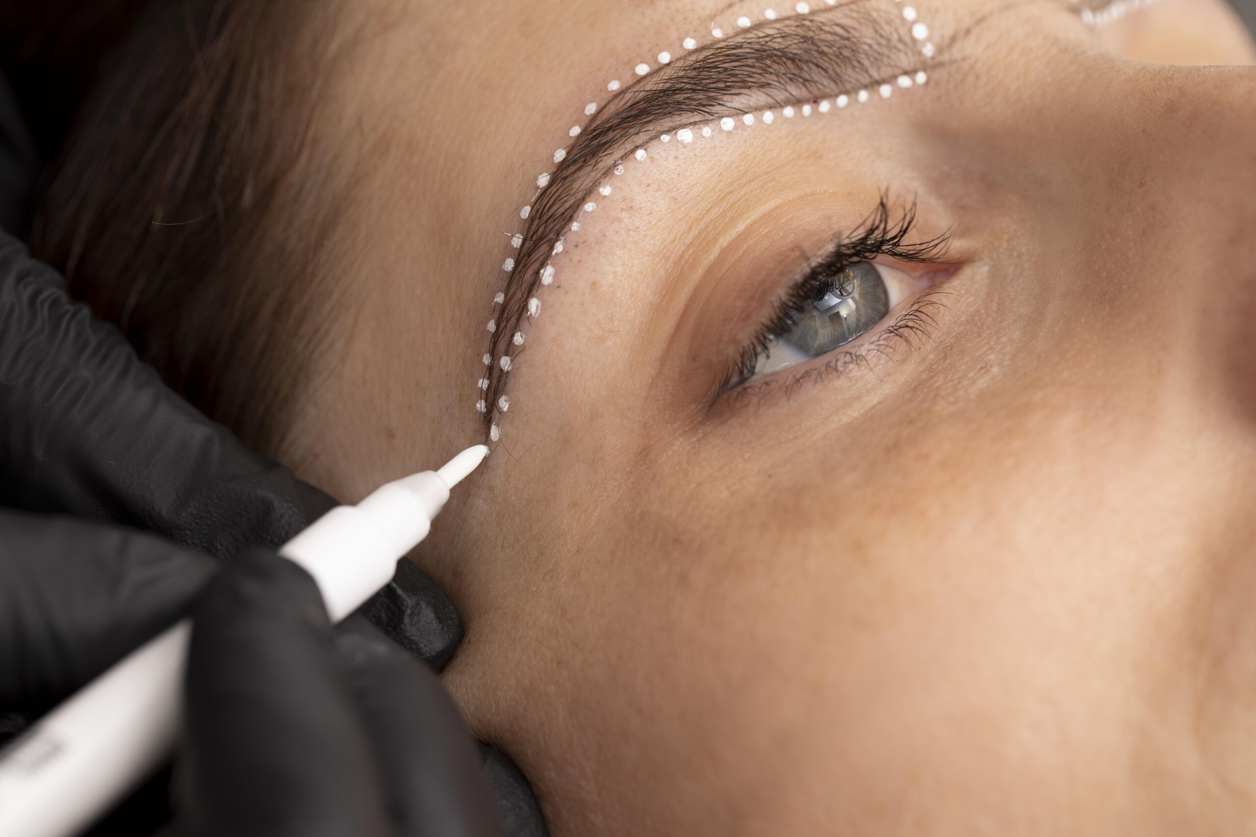 Trapianto di sopracciglia a Cayra Clinic per un aspetto naturale e simmetrico del viso