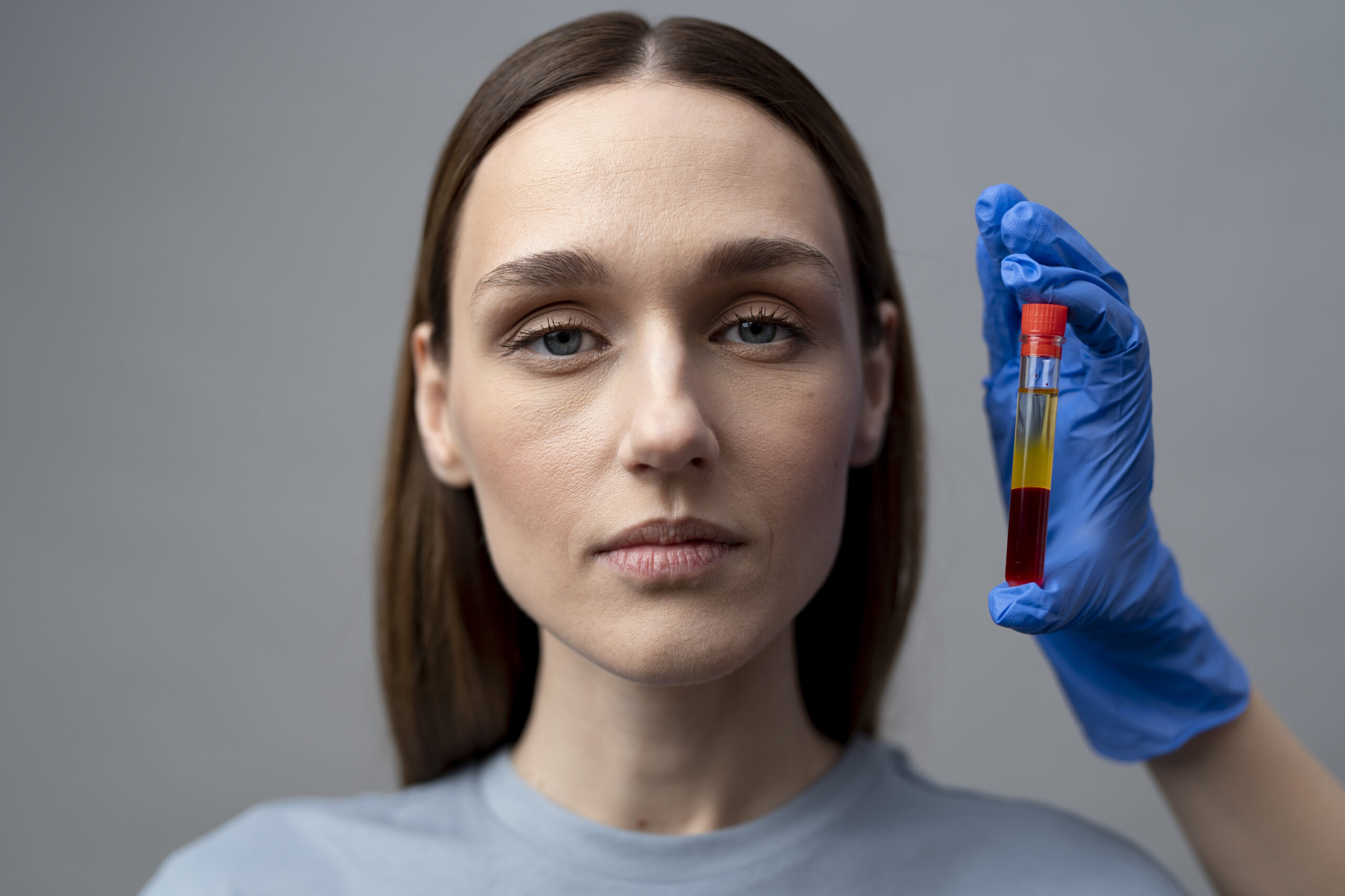 PRP per la Crescita dei Capelli