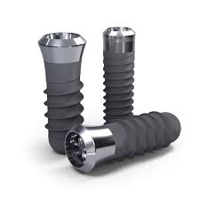 Impianti Straumann valgono davvero il prezzo guida 2026