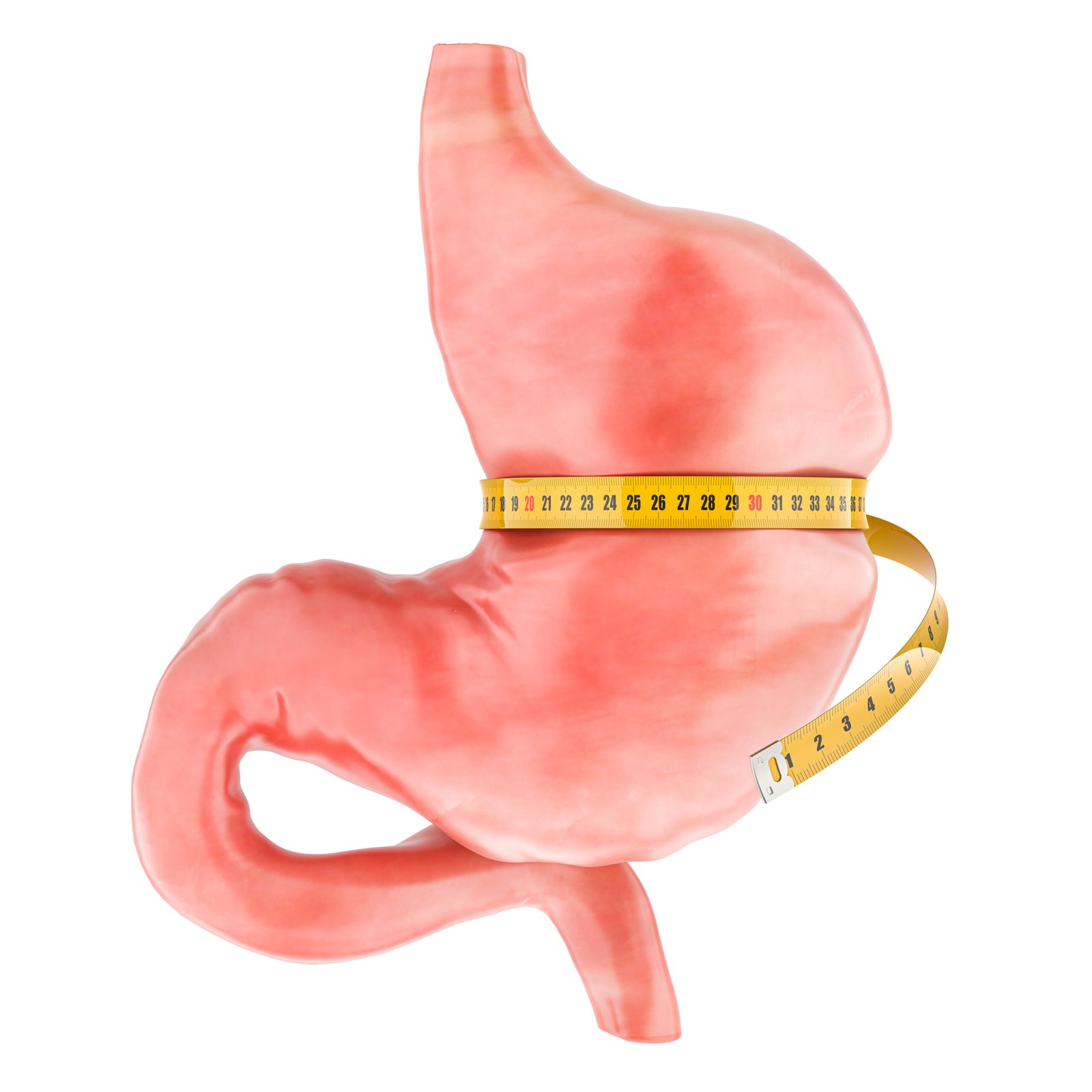 Procedura laparoscopica di posizionamento del bendaggio gastrico a Istanbul