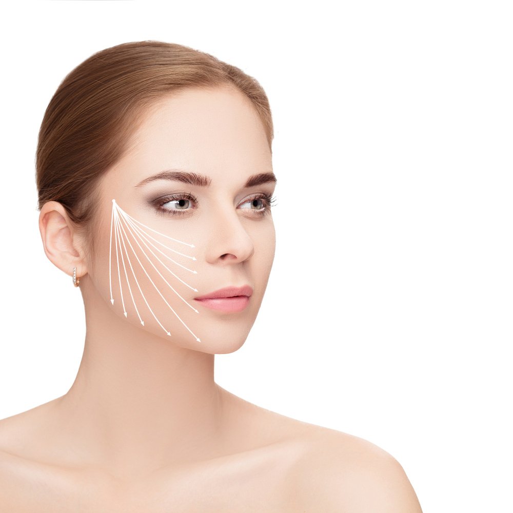 Applicazione dello Spider Web Lift sul viso di una paziente